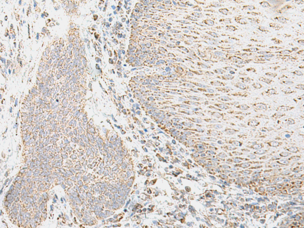 Rabbit Polyclonal Antibody to ITGB6