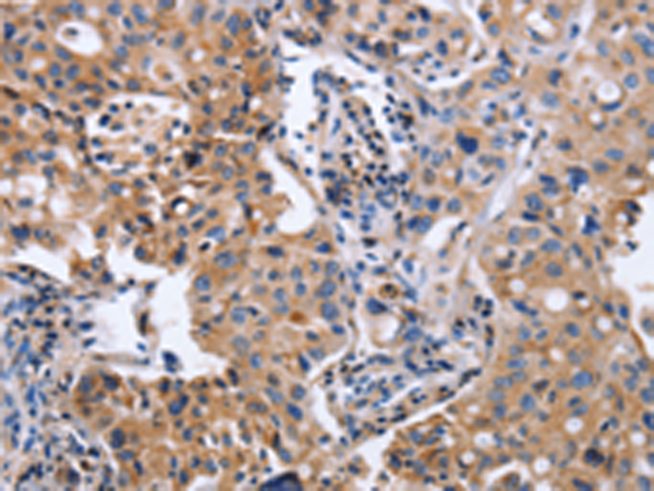 Rabbit Polyclonal Antibody to ITGB5