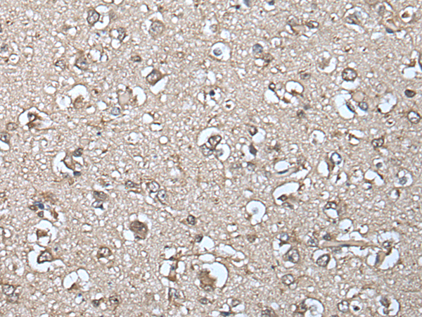 Rabbit Polyclonal Antibody to IRF4