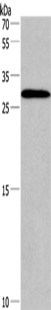 Rabbit Polyclonal Antibody to IRAK1BP1