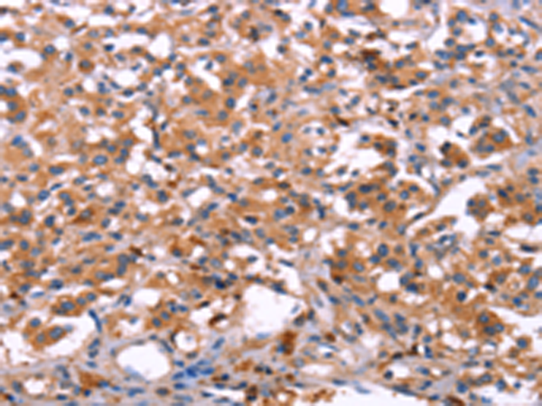Rabbit Polyclonal Antibody to LILRB1