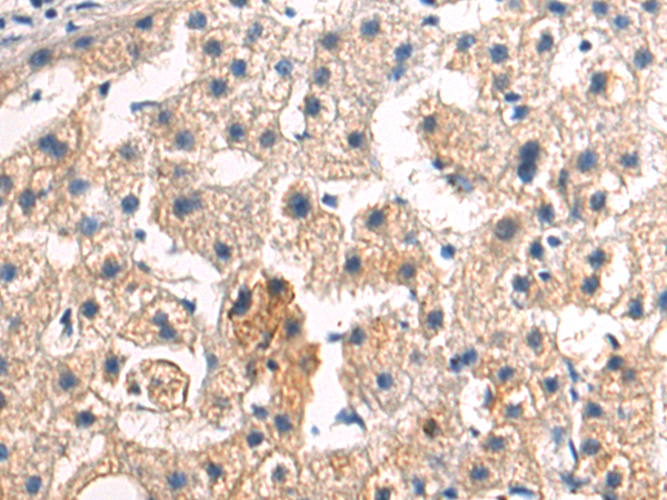 Rabbit Polyclonal Antibody to ITGA4