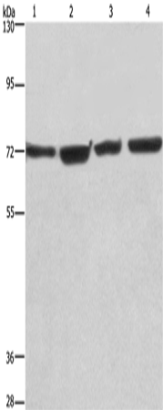 Rabbit Polyclonal Antibody to KLF11
