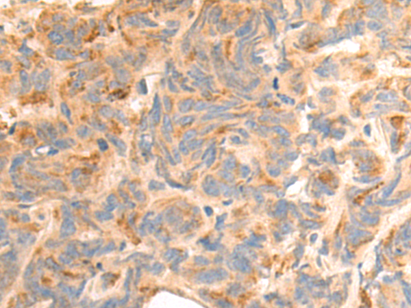 Rabbit Polyclonal Antibody to KLK4