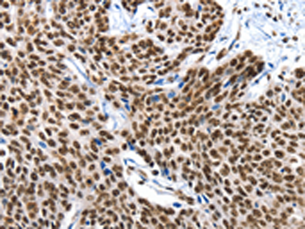 Rabbit Polyclonal Antibody to XRCC6