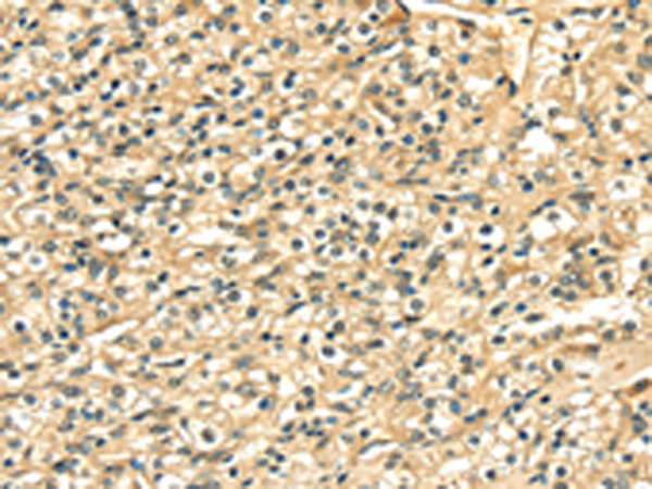 Rabbit Polyclonal Antibody to LAMA4