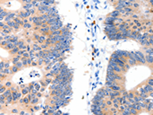 Rabbit Polyclonal Antibody to LAT2