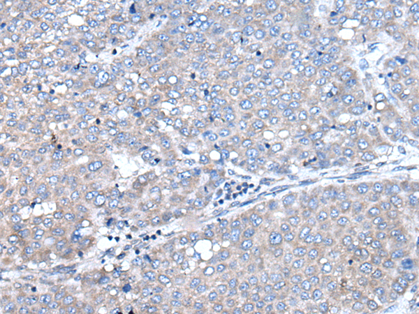 Rabbit Polyclonal Antibody to LCAT