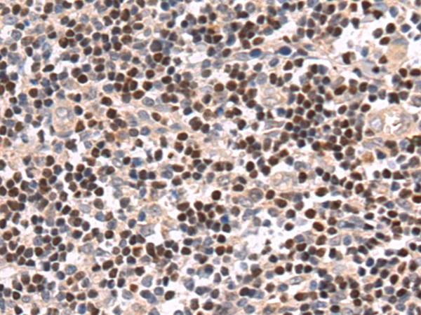 Rabbit Polyclonal Antibody to LEF1