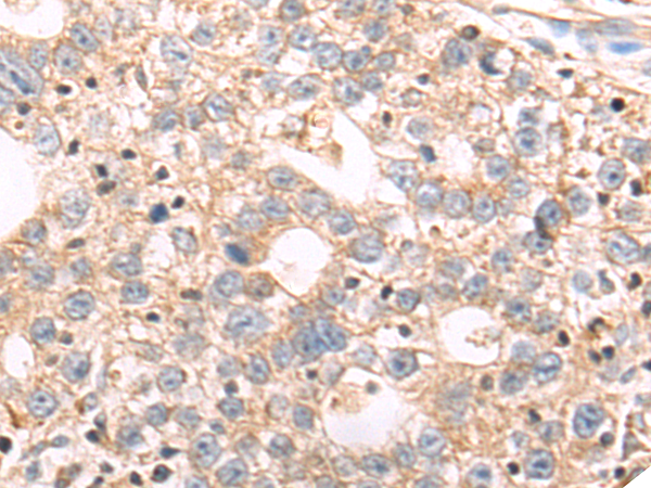 Rabbit Polyclonal Antibody to LGR5
