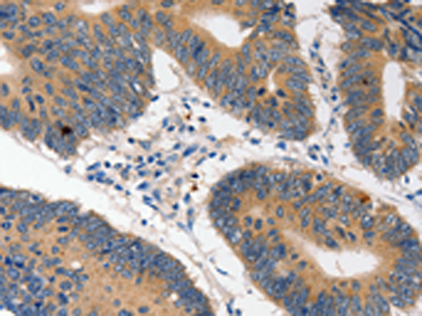 Rabbit Polyclonal Antibody to HDC