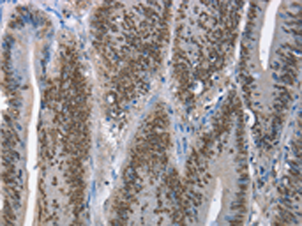 Rabbit Polyclonal Antibody to GNRH1