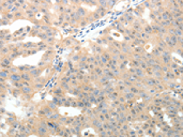 Rabbit Polyclonal Antibody to LRP12