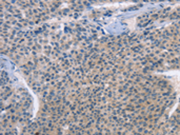 Rabbit Polyclonal Antibody to LRRK2