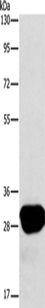 Rabbit Polyclonal Antibody to LXN