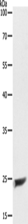 Rabbit Polyclonal Antibody to MAD2L1