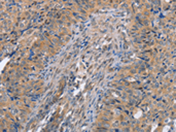 Rabbit Polyclonal Antibody to MAP2K1
