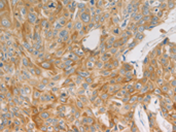 Rabbit Polyclonal Antibody to MAP2K6