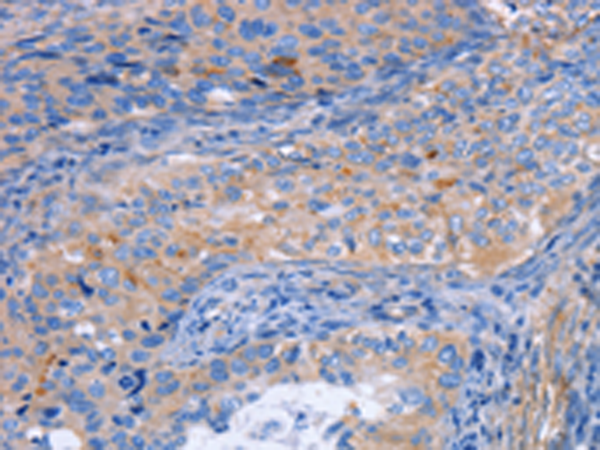 Rabbit Polyclonal Antibody to MATN3