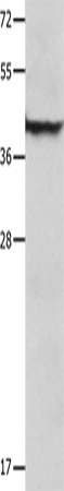 Rabbit Polyclonal Antibody to SERPINB5
