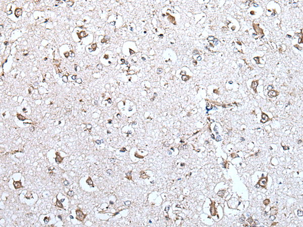 Rabbit Polyclonal Antibody to MCM10