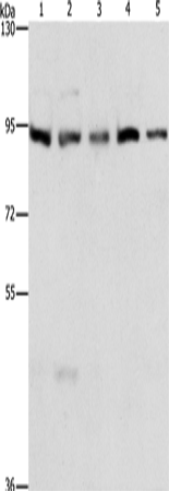Rabbit Polyclonal Antibody to MCM5
