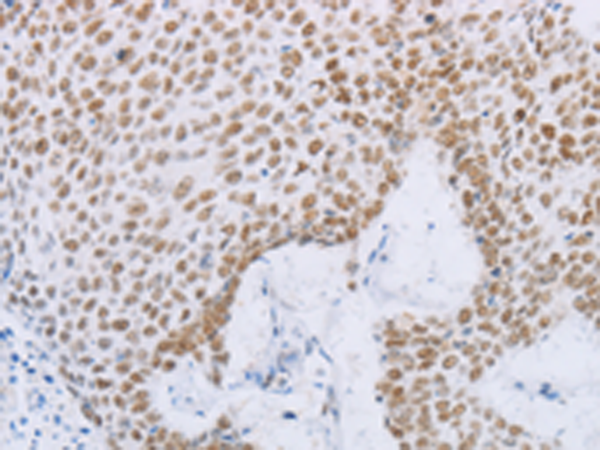 Rabbit Polyclonal Antibody to MCM2