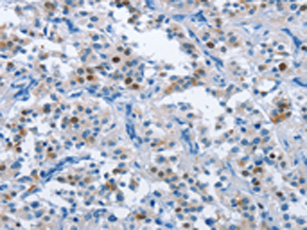 Rabbit Polyclonal Antibody to MCM7