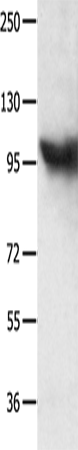 Rabbit Polyclonal Antibody to MCM8