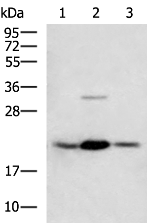 Rabbit Polyclonal Antibody to MGMT
