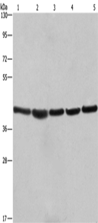 Rabbit Polyclonal Antibody to RPSA