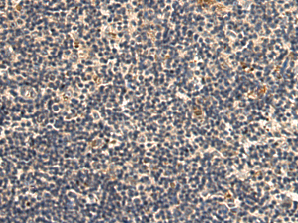 Rabbit Polyclonal Antibody to MYLK2