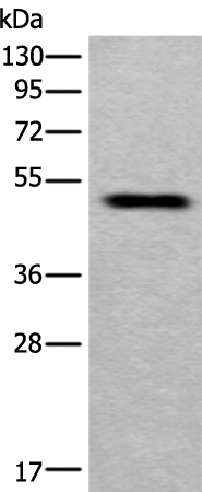 Rabbit Polyclonal Antibody to MMP12