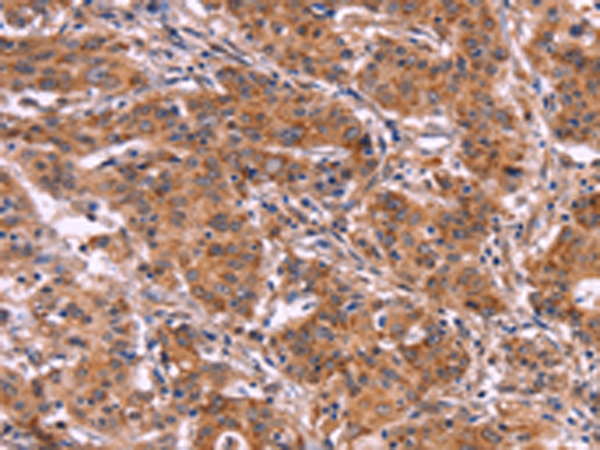 Rabbit Polyclonal Antibody to MMP14