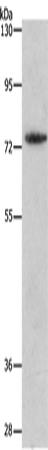 Rabbit Polyclonal Antibody to MMP15