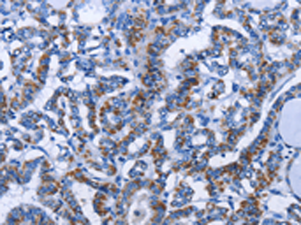 Rabbit Polyclonal Antibody to MMP16