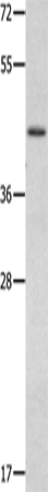 Rabbit Polyclonal Antibody to MMP28