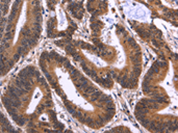 Rabbit Polyclonal Antibody to MSH4