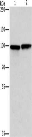 Rabbit Polyclonal Antibody to MSH5