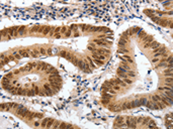 Rabbit Polyclonal Antibody to MSH3