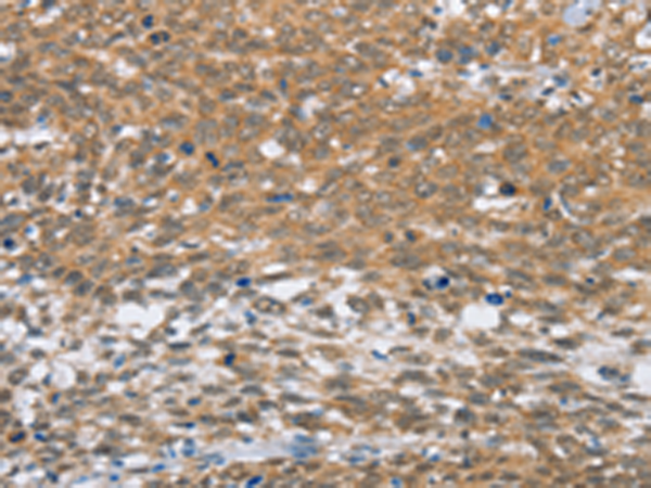 Rabbit Polyclonal Antibody to MLH1