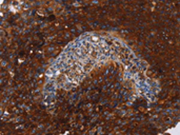 Rabbit Polyclonal Antibody to MSLN