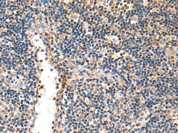 Rabbit Polyclonal Antibody to MLN