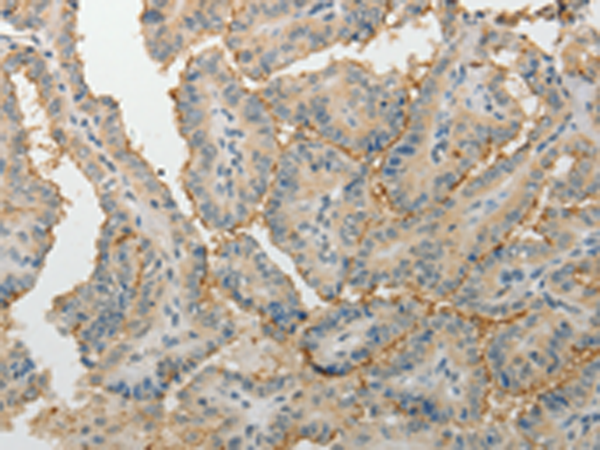 Rabbit Polyclonal Antibody to MPZ