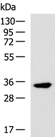 Rabbit Polyclonal Antibody to MYOZ1