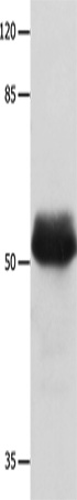 Rabbit Polyclonal Antibody to MUTYH