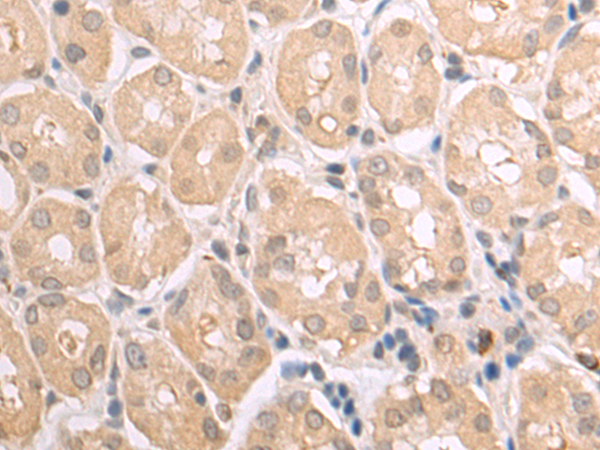 Rabbit Polyclonal Antibody to MYH7