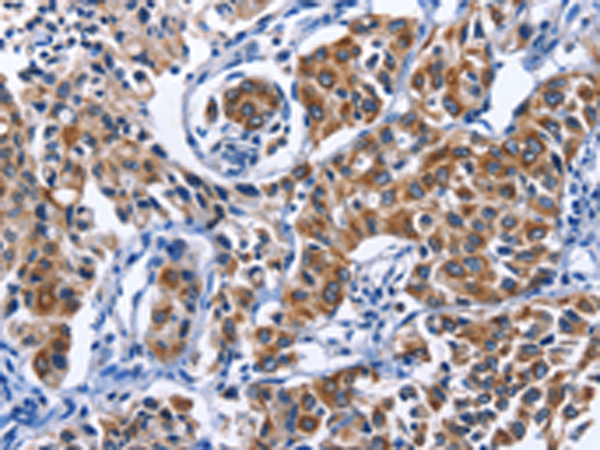 Rabbit Polyclonal Antibody to MYH1