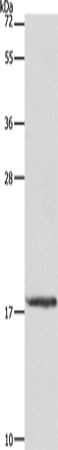 Rabbit Polyclonal Antibody to MYL6