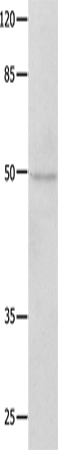 Rabbit Polyclonal Antibody to NAP1L1